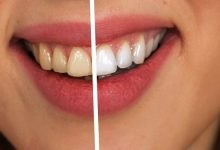 Ağız ve Diş Sağlığı